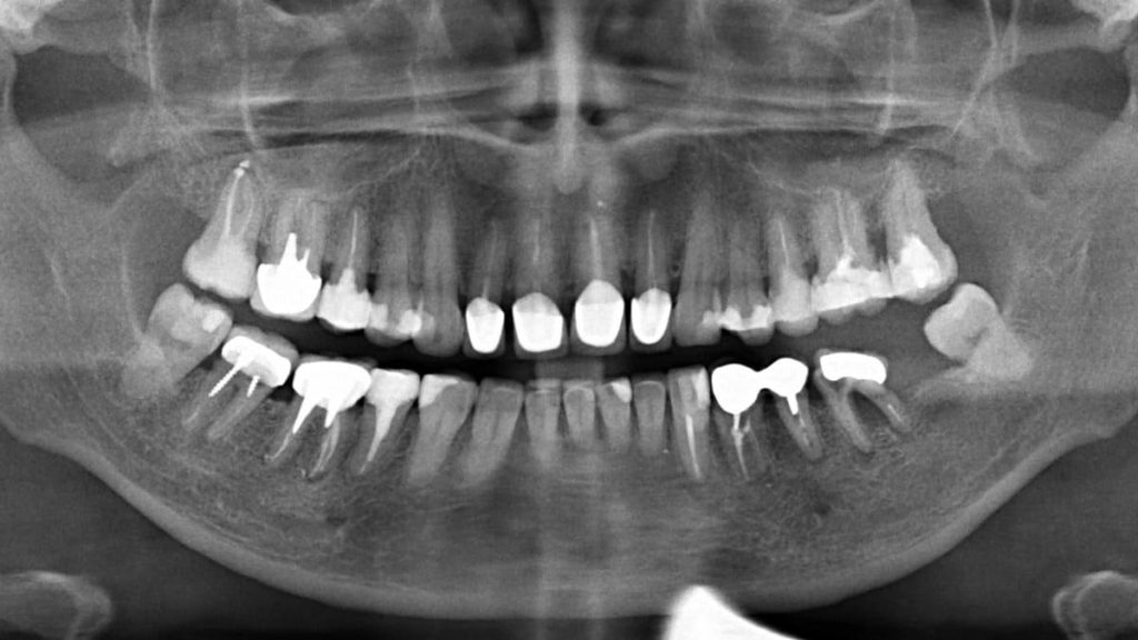 Рентген зубов в городе Раменское